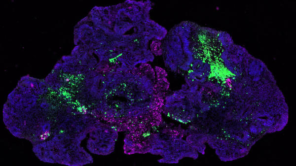 Organoids: A new window into disease, development and discovery
