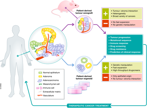 Xenograft and organoid model systems in cancer research