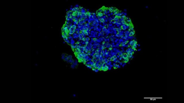 First Epigenetic Study in 3D Human Cancer Cells Performed