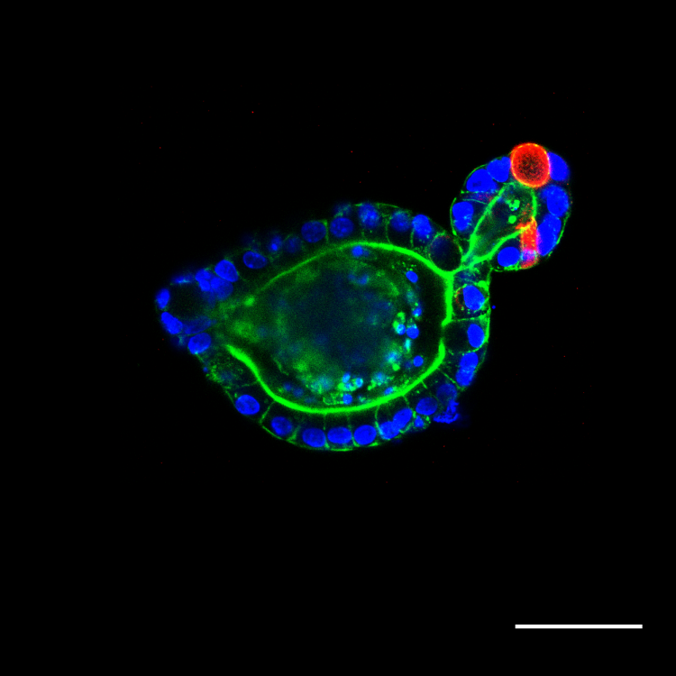 New paper explores organoid growth and development, illustrates new route for control